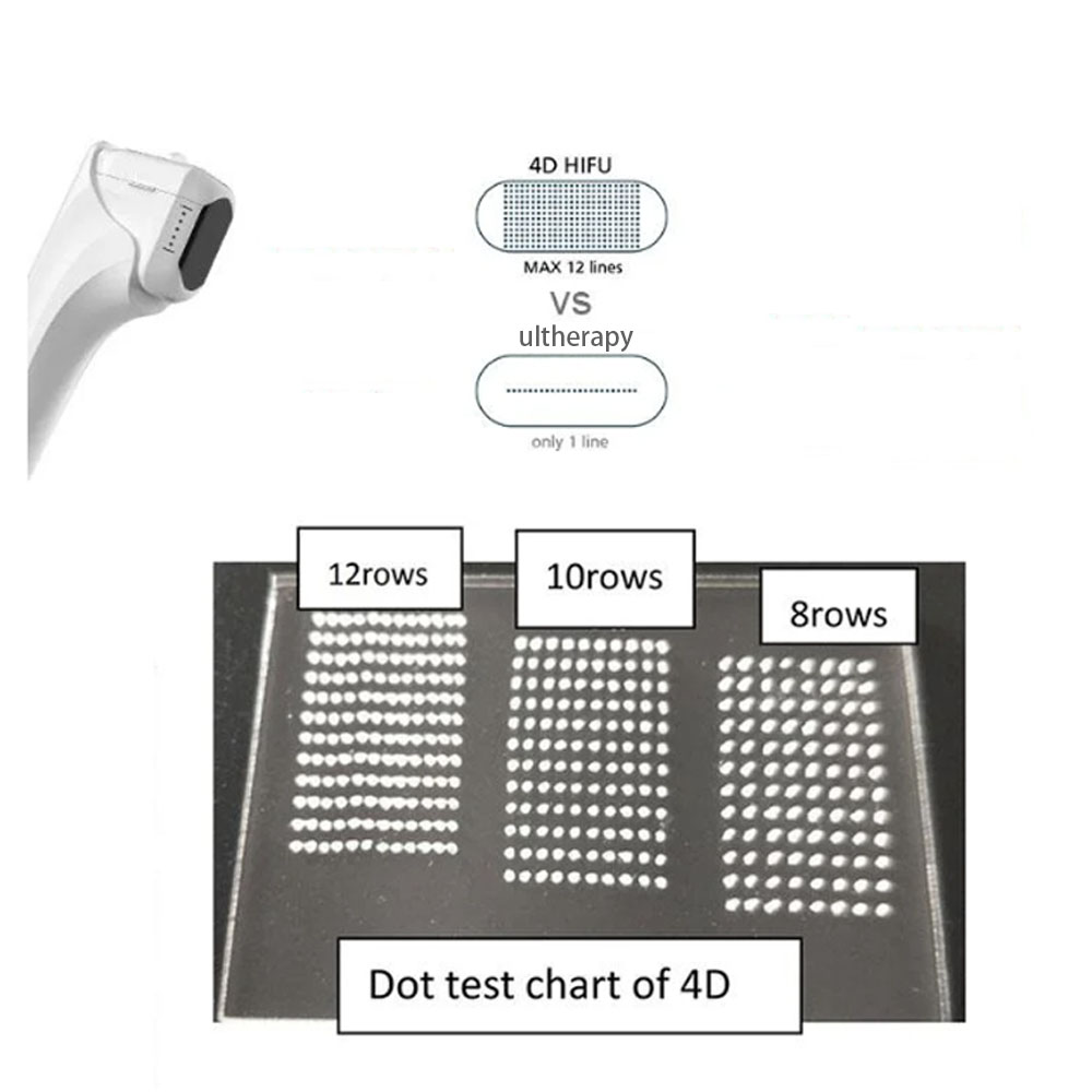 4D hifu machine